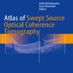 Atlas.of.Swept.Source.Optical.Coherence.[taliem.ir]