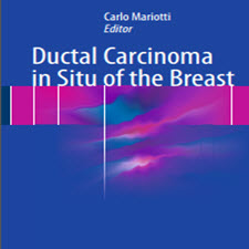 Ductal.Carcinoma.in.Situ.of.the.[taliem.ir]