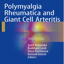 Polymyalgia.Rheumatica.and.Giant.Cell.Arteritis.[taliem.ir]