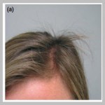 A practical, algorithmic approach to diagnosing hair shaft[taliem.ir]
