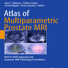 Atlas.of.Multiparametric.Prostate.MRI.[taliem.ir]