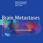 Brain.Metastases.Advanced.Neuroimaging.[taliem.ir]