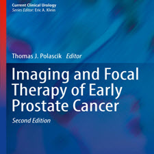 Imaging.and.Focal.Therapy.of.Early.Prostate.Cancer.[taliem.ir]