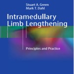 Intramedullary.Limb.Lengthening.Principles.[taliem.ir]