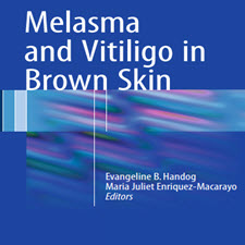 Melasma.and.Vitiligo.in.Brown.Skin-taliem.ir